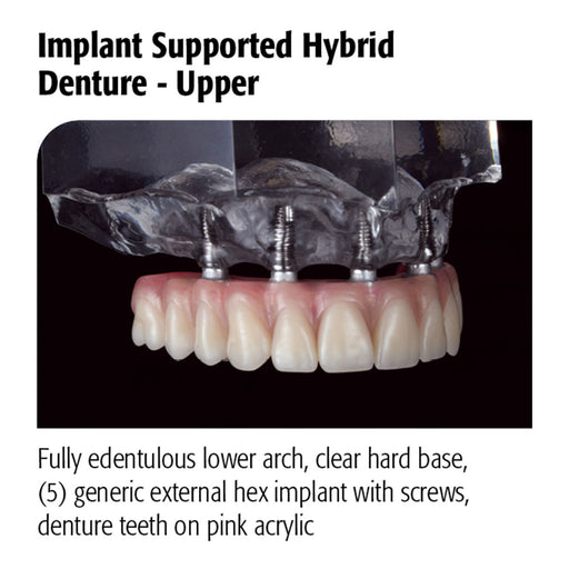 Avtec Dental - Implant Supported Hybrid Denture – Upper - Maverick Rotary™