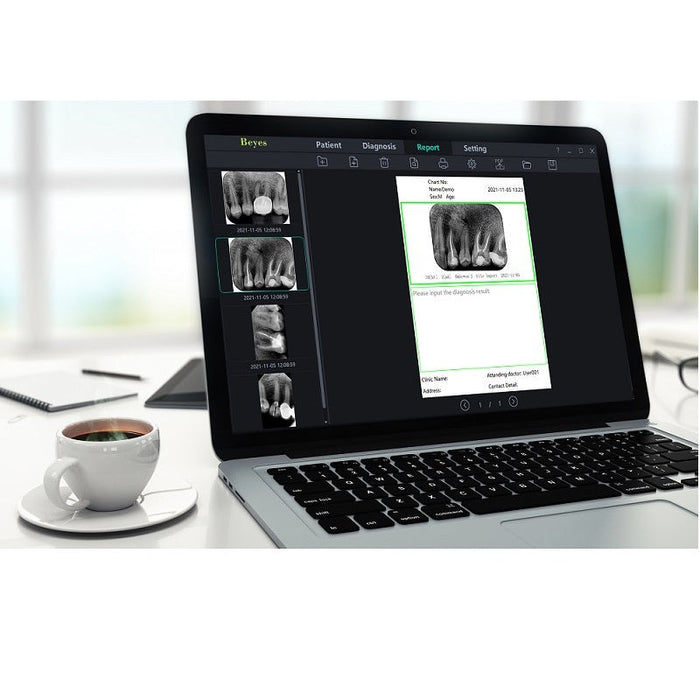 Duray® Digital Intraoral Sensor - Avtec Dental