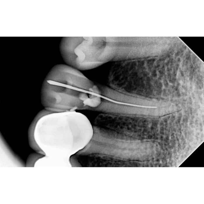 Duray® Digital Intraoral Sensor - Avtec Dental