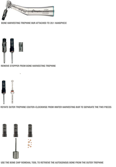 Ultimate Bone Harvesting Trephine Kit - Nexxgen Biomedical® - Avtec Dental