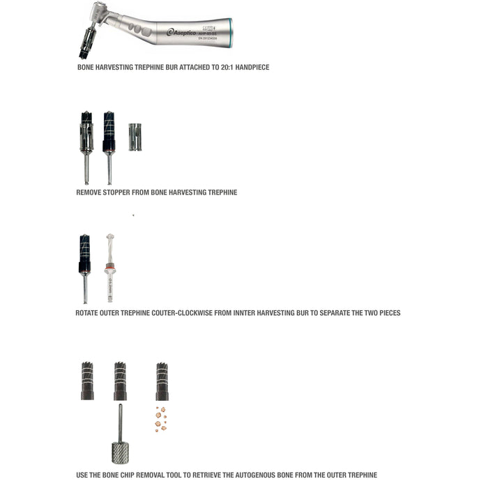 Ultimate Bone Harvesting Trephine Kit - Nexxgen Biomedical® - Avtec Dental