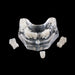 PB-5 Implant Crown & Bridge Combination - Avtec Dental