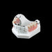 PB-3 Partial Framework - Avtec Dental