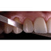 Maverick Diamond Finishing Strips - Avtec Dental