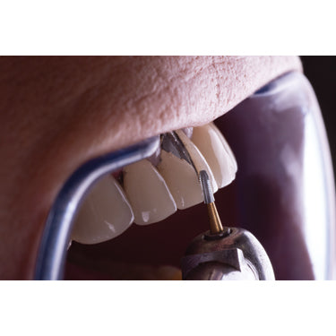 Terminator T-2 Specialty Carbide Metal Crown Removal Burs - Avtec Dental