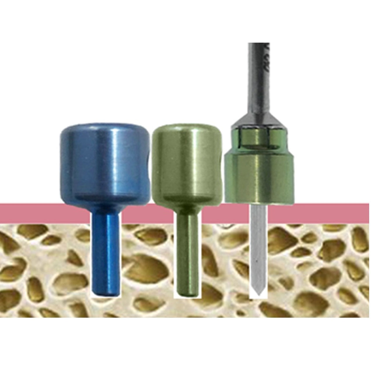 Bone Collector and Guide Kit (3 in 1 Kit) Avtec Dental