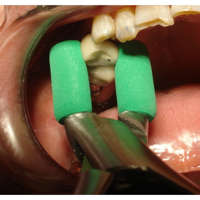 TempOff® Crown Gripps™ - Avtec Dental