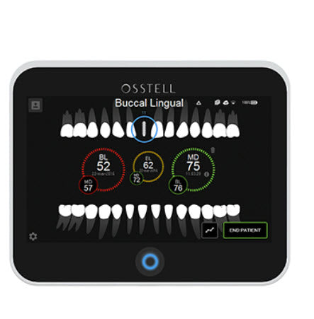 Osstell IDx - Avtec Dental