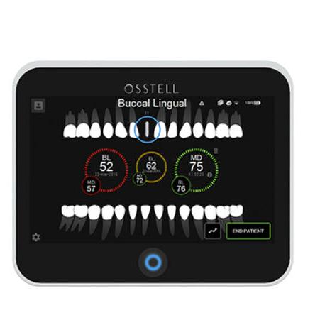 Osstell IDx - Avtec Dental
